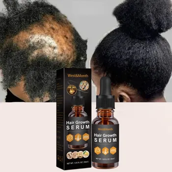 Эфирное масло для роста волос для чернокожих женщин Спрей с эфирными маслами Восстанавливает повреждения, Мягкость, Быстрое лечение, Предотвращает истончение, сухость